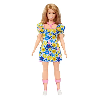 Poupée Barbie Fashionista trisomique