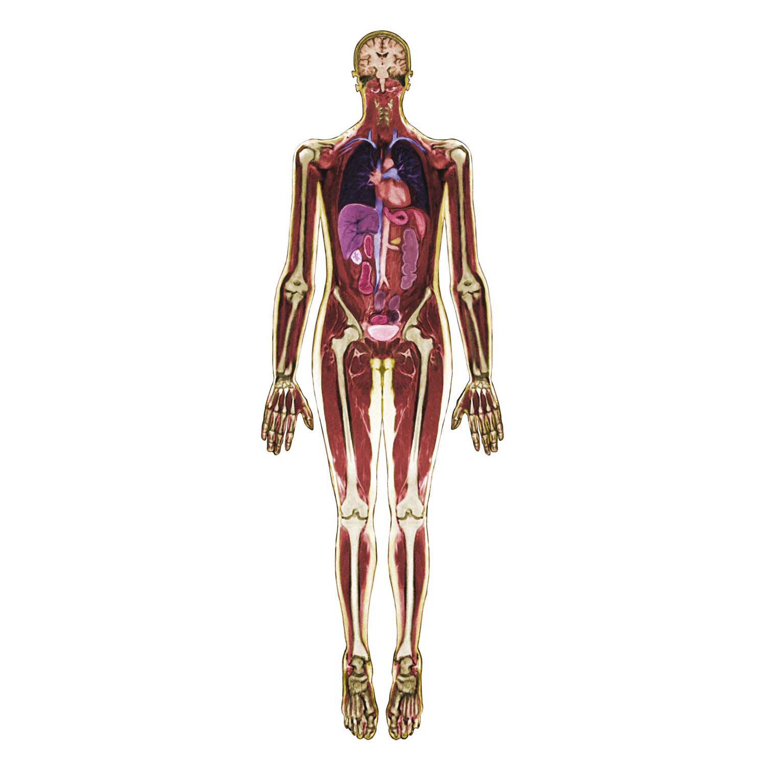 MRI-Scan Lichaam - 3dlg.